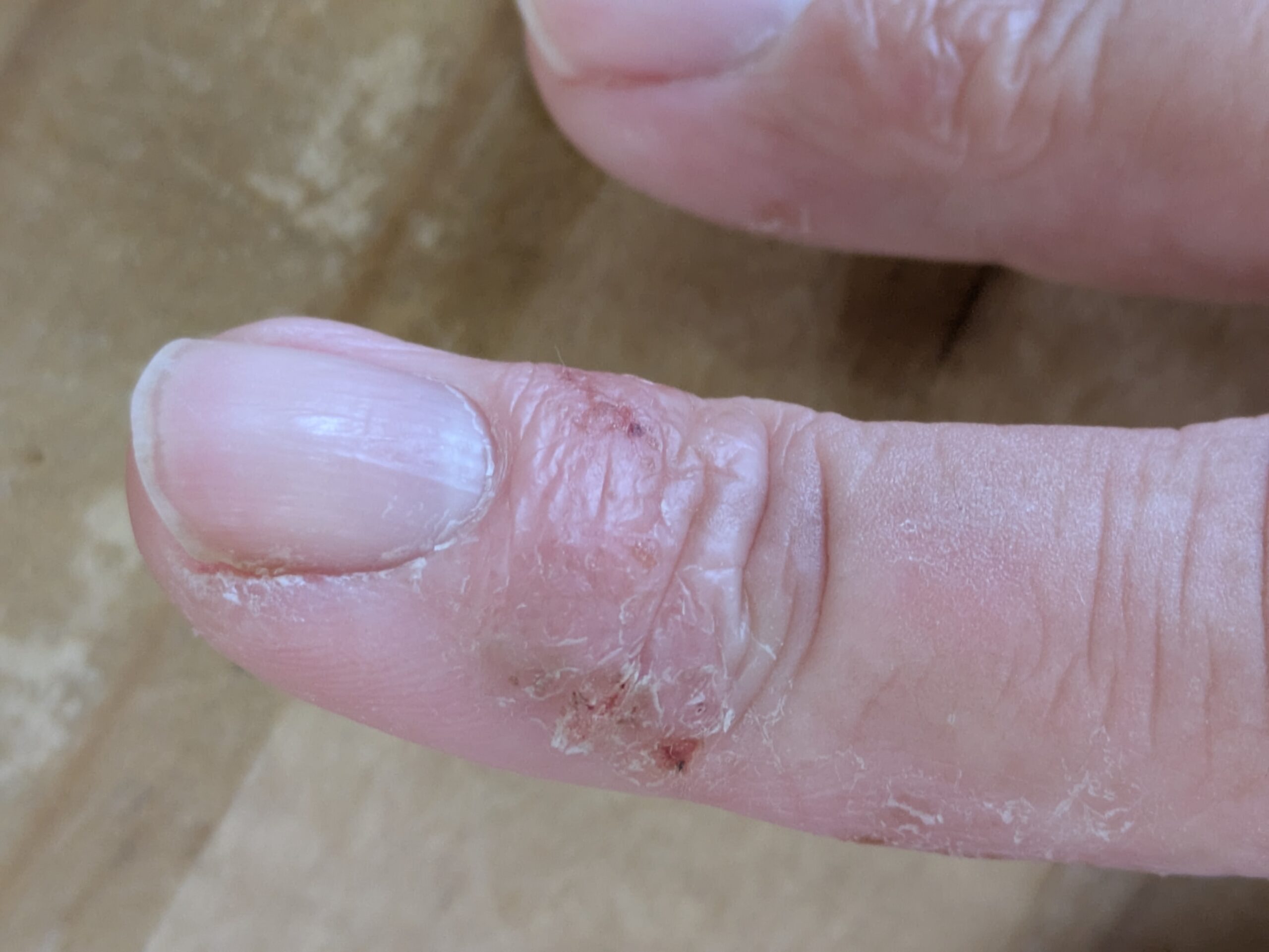 漢方治療前の皮膚の状態