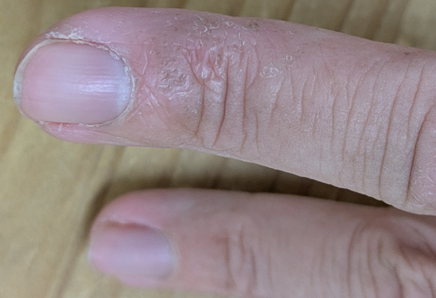 漢方治療後の皮膚の状態